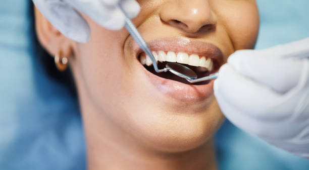 Best Dental Abscess Treatment in Bridgetown, MS